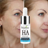 Image of MABOX Hyaluronic Acid